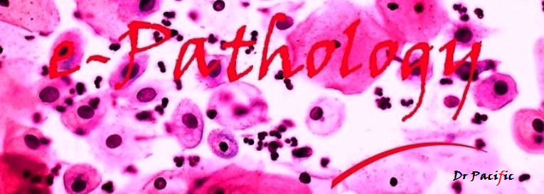 Pathology Review Questions Free