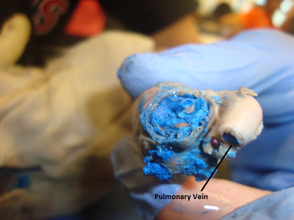 Pig Dissection: Day 4 - Excretory, Respiratory, Circulatory, and