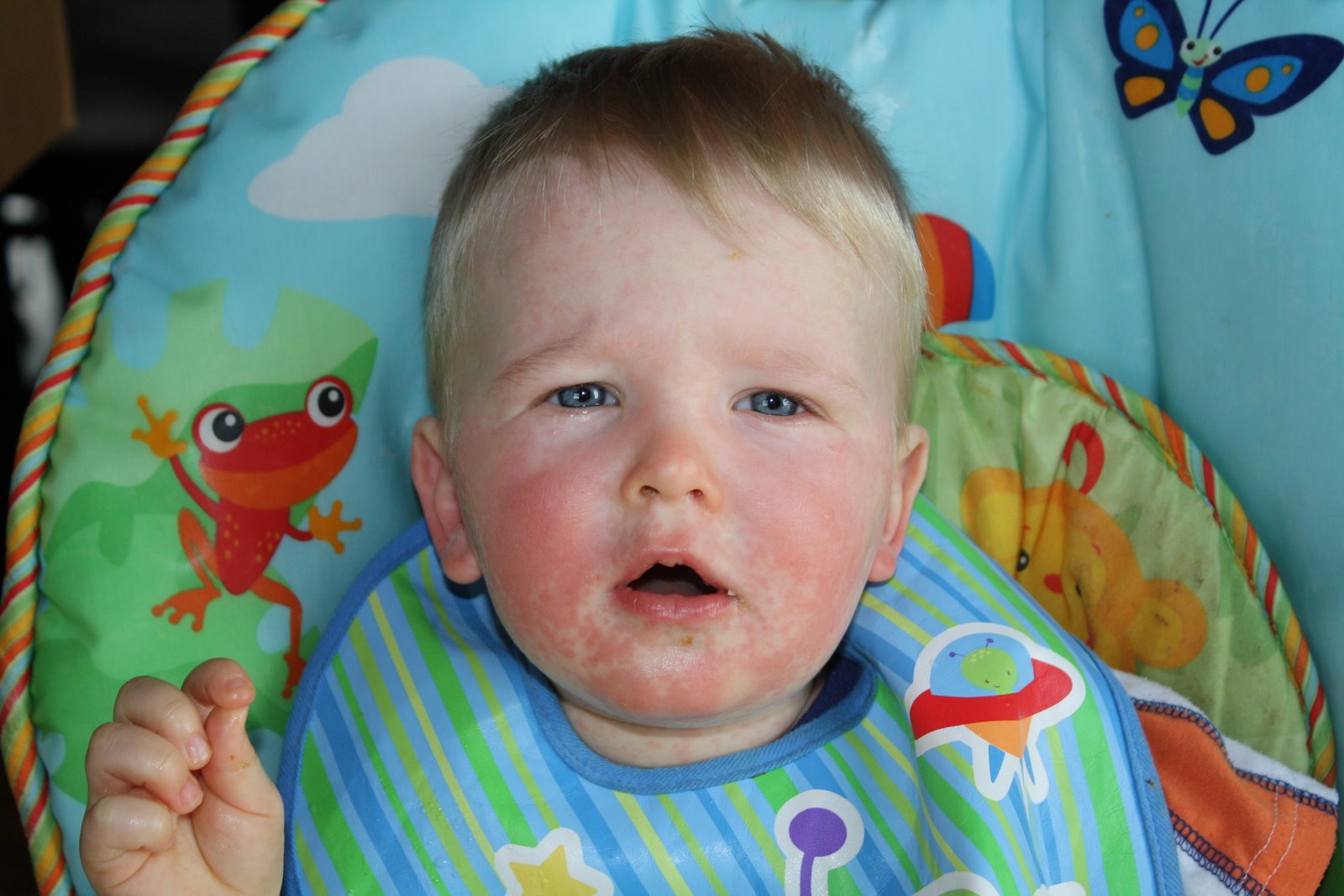 The Mommy Diaries Cael's Reaction to Amoxicillin