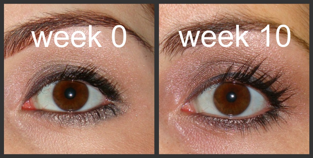 Prettied Up: My dramatic results after using Latisse for 10 weeks