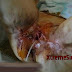 Gambar Kemaluan Wanita Dibakar Oleh Suami