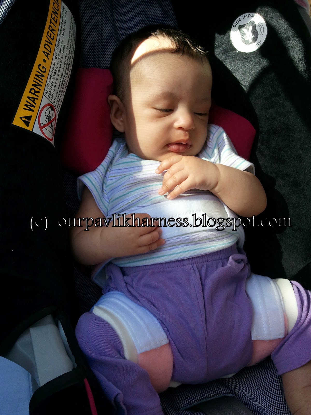 Our Pavlik Harness and journey with Hip Dysplasia May 2012