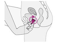 dentro da vagina o coletor menstrual vai se ajustar as paredes internas
