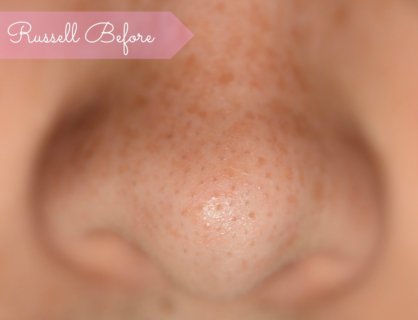 Jade Rebecca Review Bioré Deep Cleansing Pore Strips