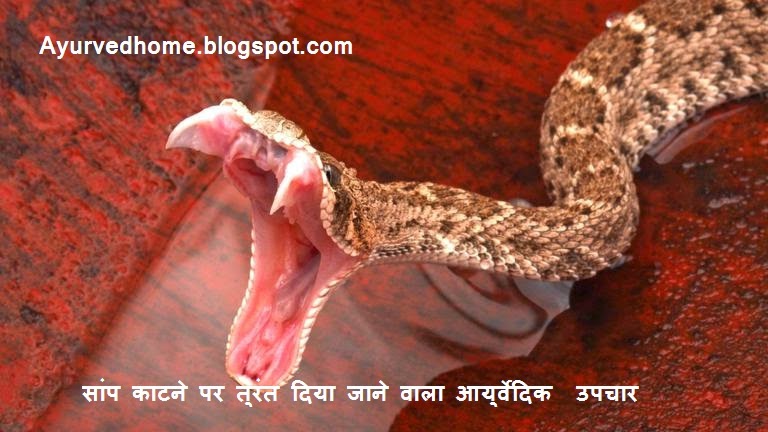 Ayurvedic treatment Given Immediately to Snake Bite  सांप काटने पर तुरंत दिया जाने वाला आयुर्वेदिक  उपचार  Saamp Ke kaatne par First Aid