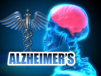 penyakit alzheimer