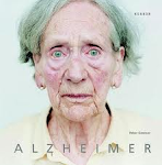 CONVIVENDO COM ALZHEIMER