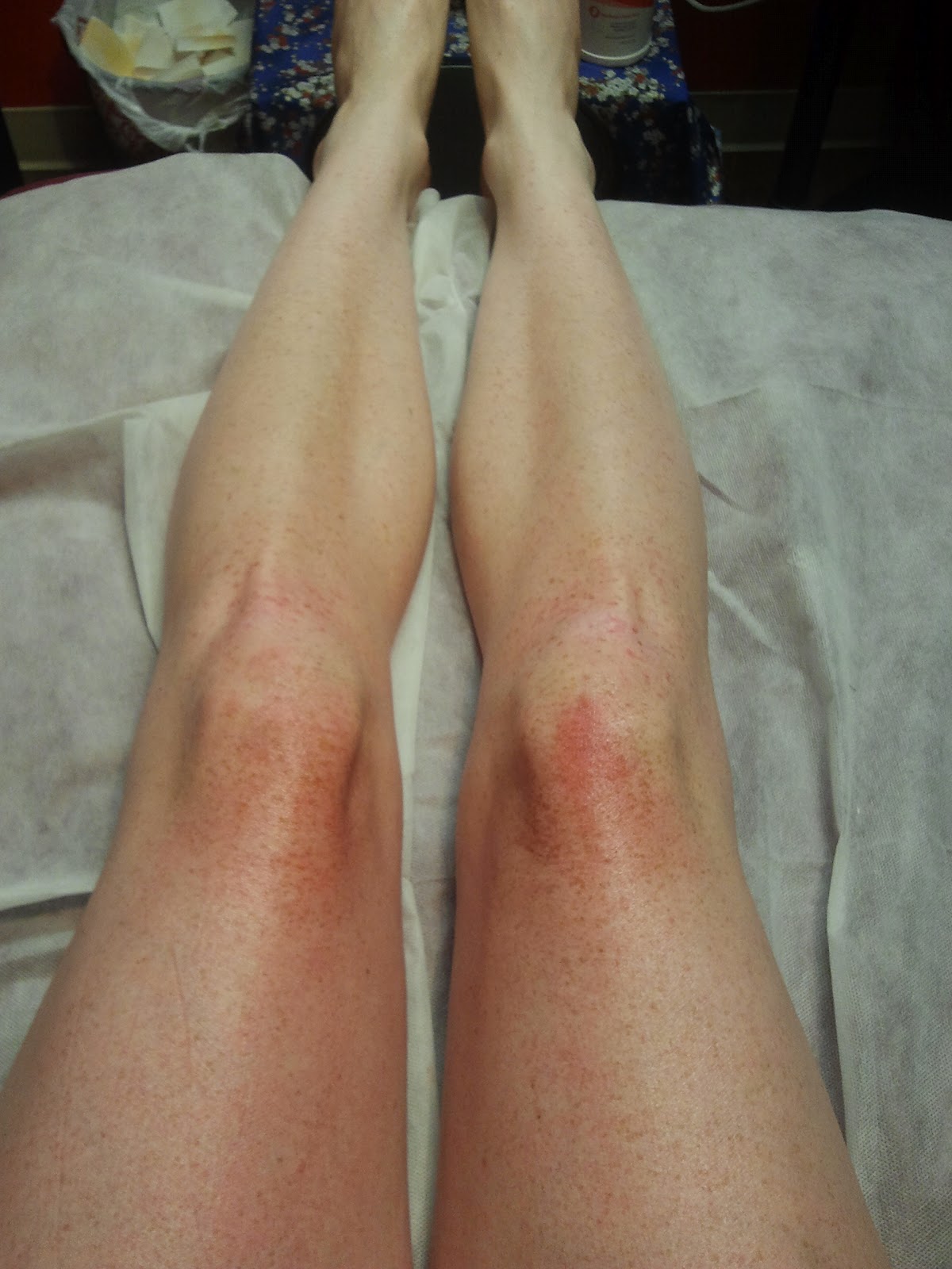 Wookie Company Remember That Time I Waxed My Legs