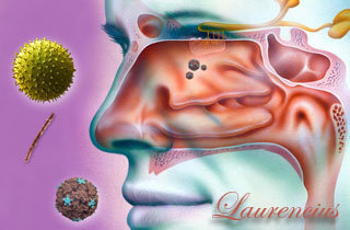 penyakit-sinusitis Pengobatan-penyakit-sinusitis