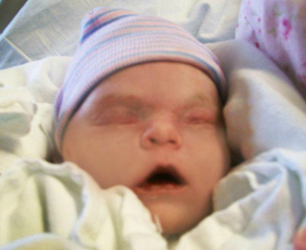 Rose and Her Lily February 2012