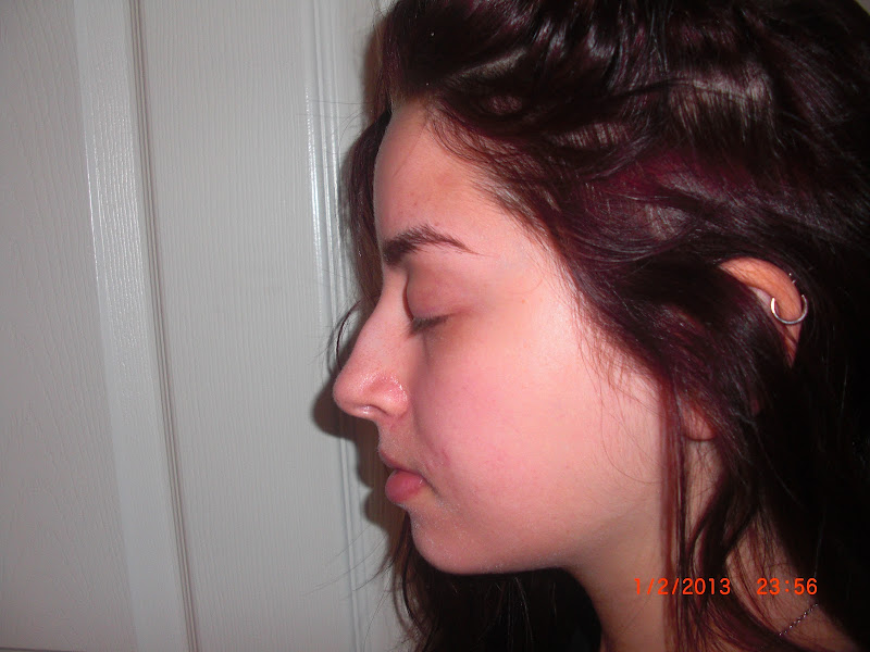 Everything basically looks the same as before, I wish my scars would title=