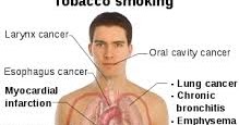 3 months after quitting smoking side effects 3 months after quitting smoking side effects