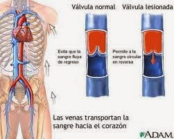 Las venas varicosas, sintomas, tratamientos y dieta de prevención