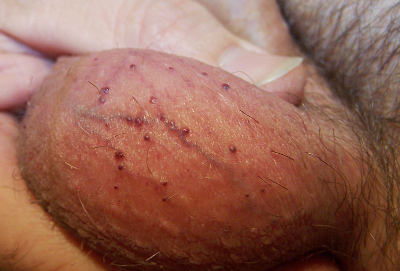 lack of feeling in the penis examining table sex