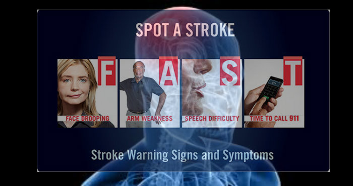 Mencegah Penyakit Stroke Mencegah Penyakit Stroke