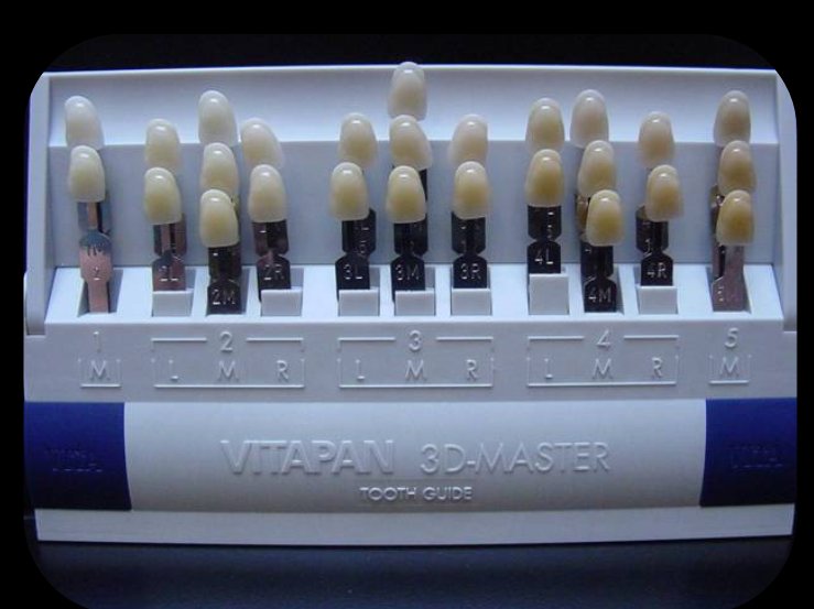 Vitapan 3D Master Shade Guide Color Measurement