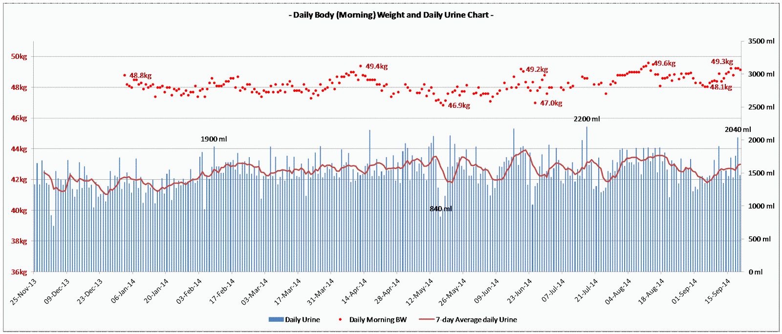 Dialysis Day A Dialysis Patient’s Daily body weight and Daily urine chart
