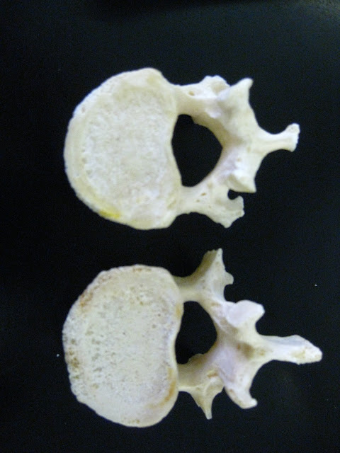 Boned: Human Skeleton - spine (vertebrae)