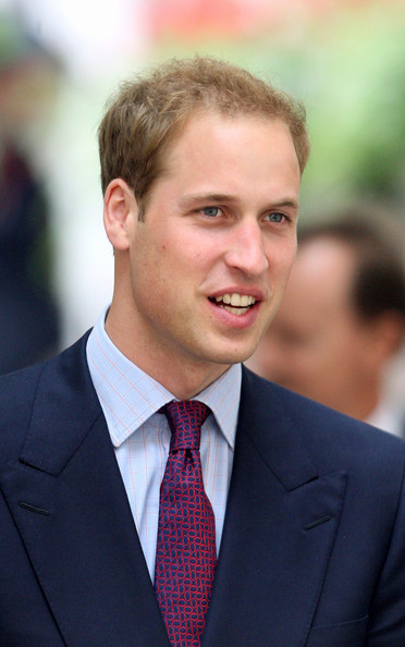 prince william hair plugs. brendan fraser hair plugs. prince william hair plugs.