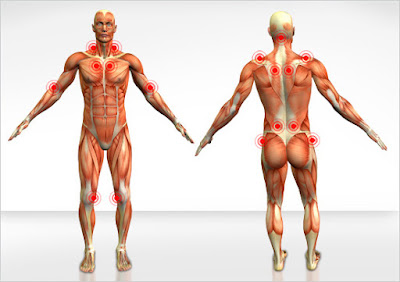 A Fibromialgia é uma das patologias que mais irradiam dor no corpo humano