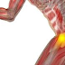 Fisioterapia na Bursite de Quadril