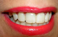 COSA SIGNIFICA SOGNARE CHE TI TOLGONO UN DENTE