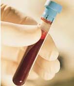 Pode tomar agua antes do exame de sangue