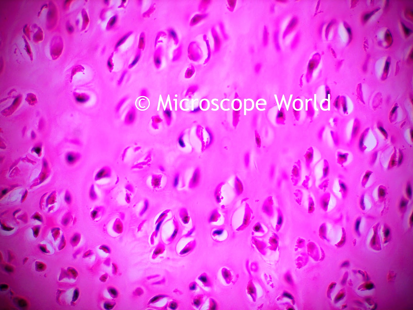 microscope image columnar ciliated epith