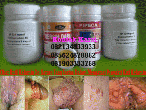 obat kutil kelamin obat kutil kelamin