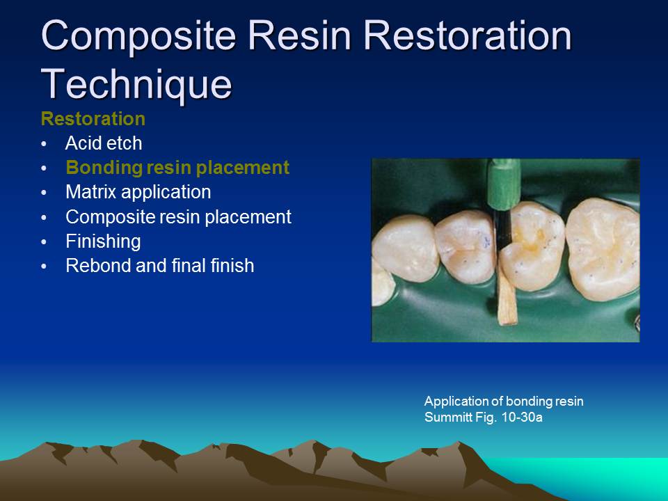 Dentistry Composite Resin