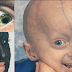 Top 10 rarest and strangest medical conditions in the world