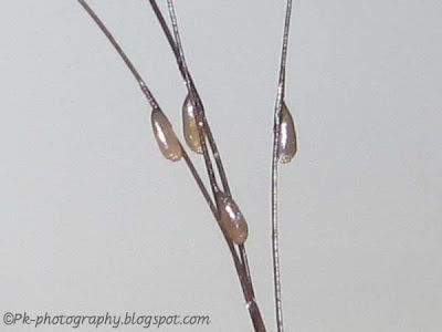 Head Lice Eggs/Nits