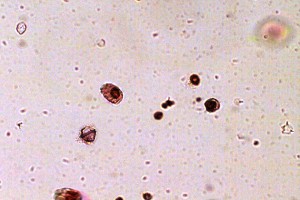 Algal Bloom With Two Toxins Could Disrupt Marine Food