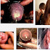 Obat Kencing Nanah Ciprofloxacin
