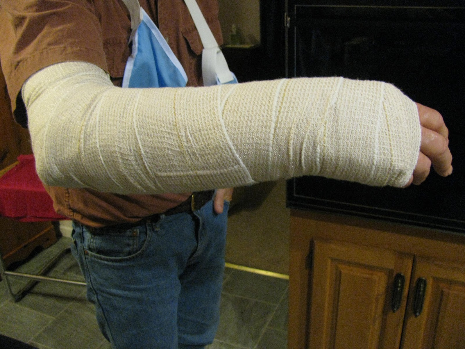 the night i broke my arm Fracture humerus i fractured my humerus this is mid week f my 5th week and it and i find it still sore and i can only raise my arm a bit outwards and to the side but i can bend it up the ways should it be mending or how many weeks does it actually take for a broken conditions and. the night i broke my arm Fracture humerus i fractured my humerus this is mid week f my 5th week and it and i find it still sore and i can only raise my arm a bit outwards and to the side but i can bend it up the ways should it be mending or how many weeks does it actually take for a broken conditions and.