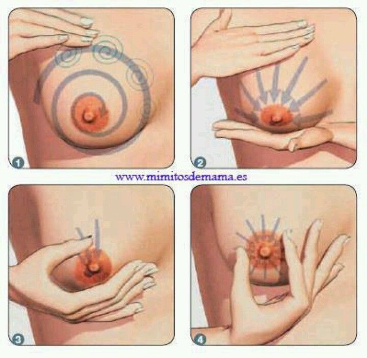 Fibrious breast and cancer