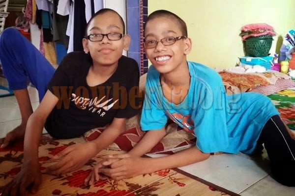4 Gambar Terkini Ahmad & Muhammad, Kembar Siam Malaysia item-thumbnail