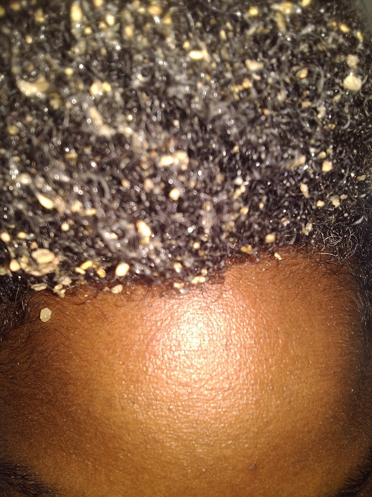 FOR THE LOVE OF FENUGREEK... A TALE OF THREE METHODS IN A PURSUIT TO