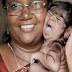 ولادة طفلة هندية "مستذئبة" مغطاة بالشعر