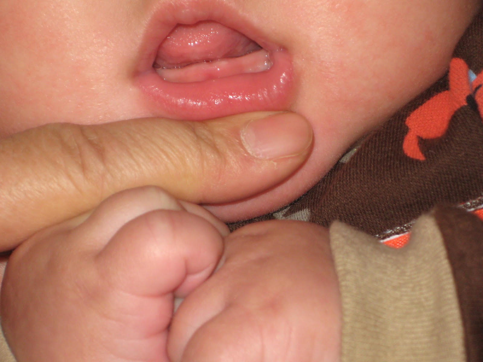 baby tooth bud