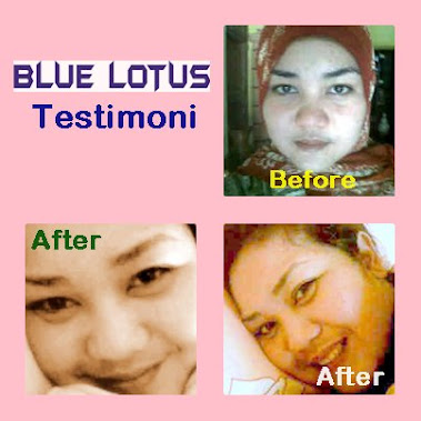 Blue Lotus Lightening