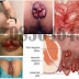 Obat Salep Anus Bengkak Sakit dan Gatal2 thumbnail