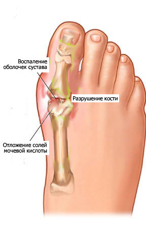 Боль в ухе без причин