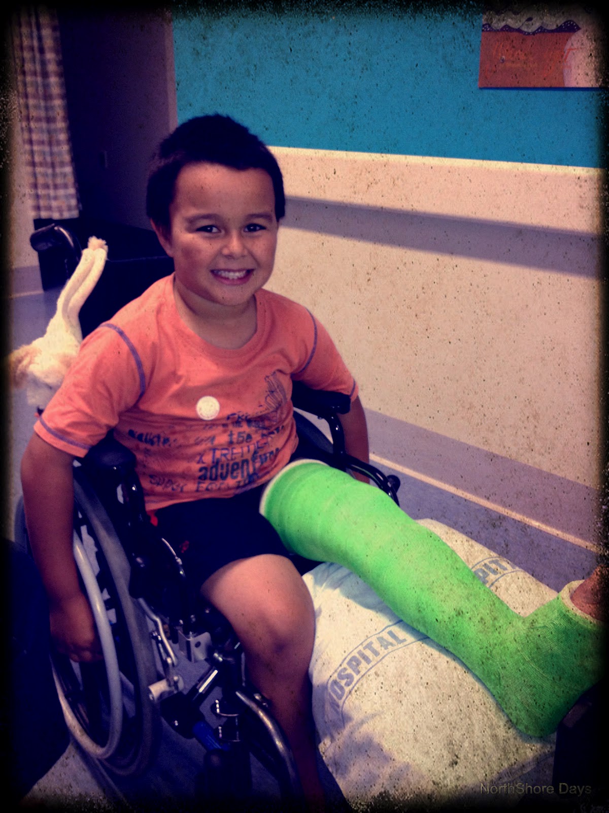 NorthShore Days..... 10 Good Things About A Broken Leg