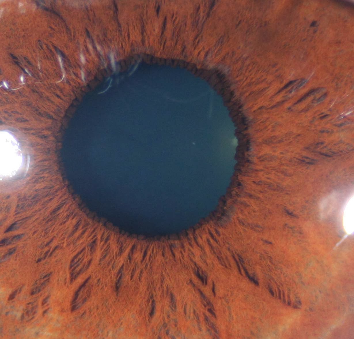 Modern & Multidimensional Iridology The Inner Pupillary Border