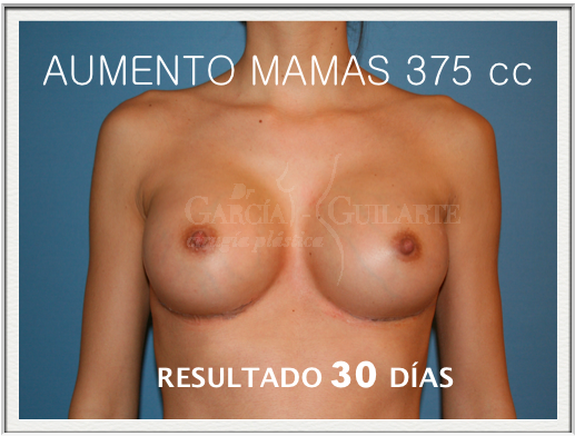 Como aumentar el pecho en simferopole