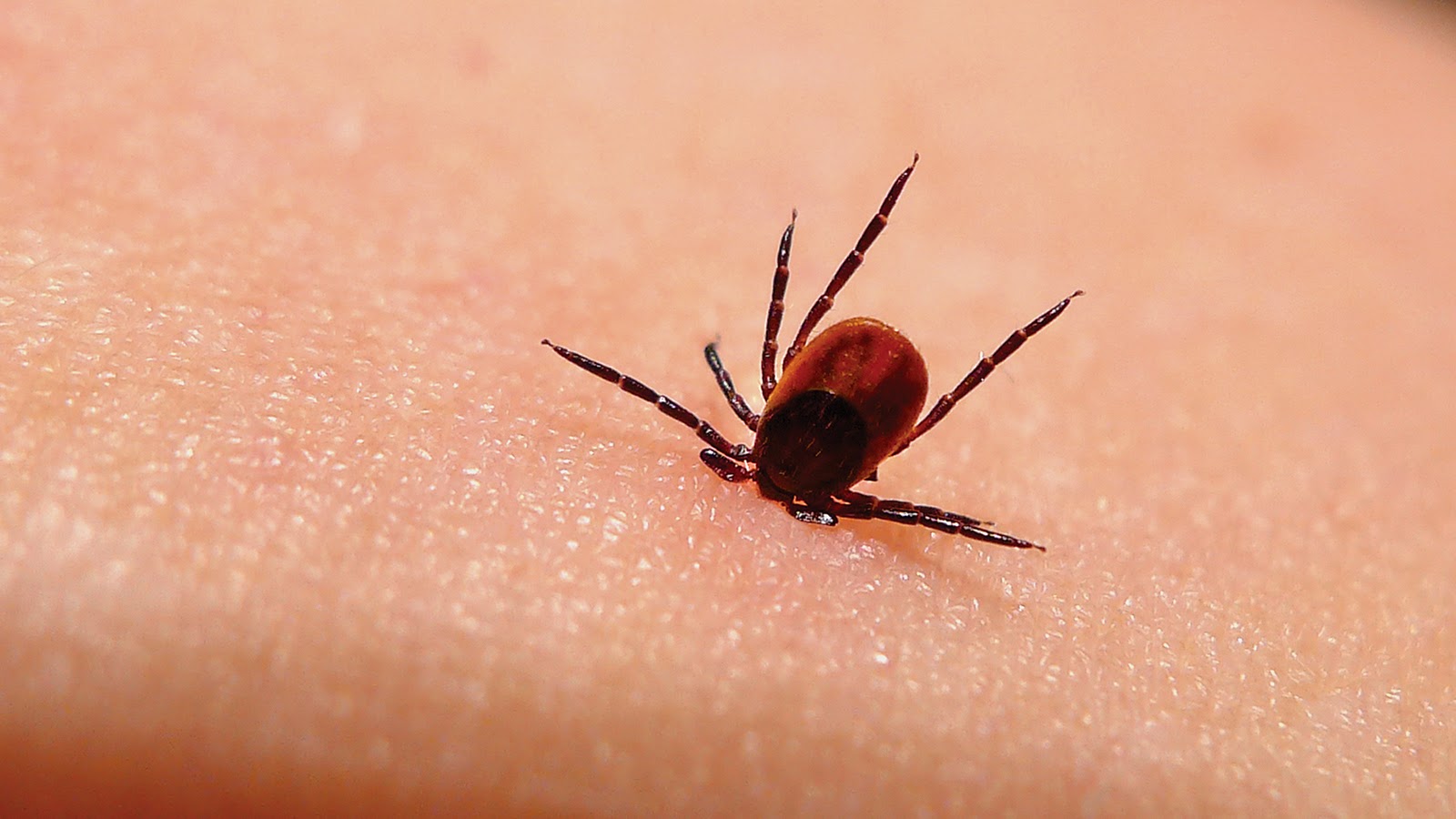 Lyme Disease Contagious Health and Disease