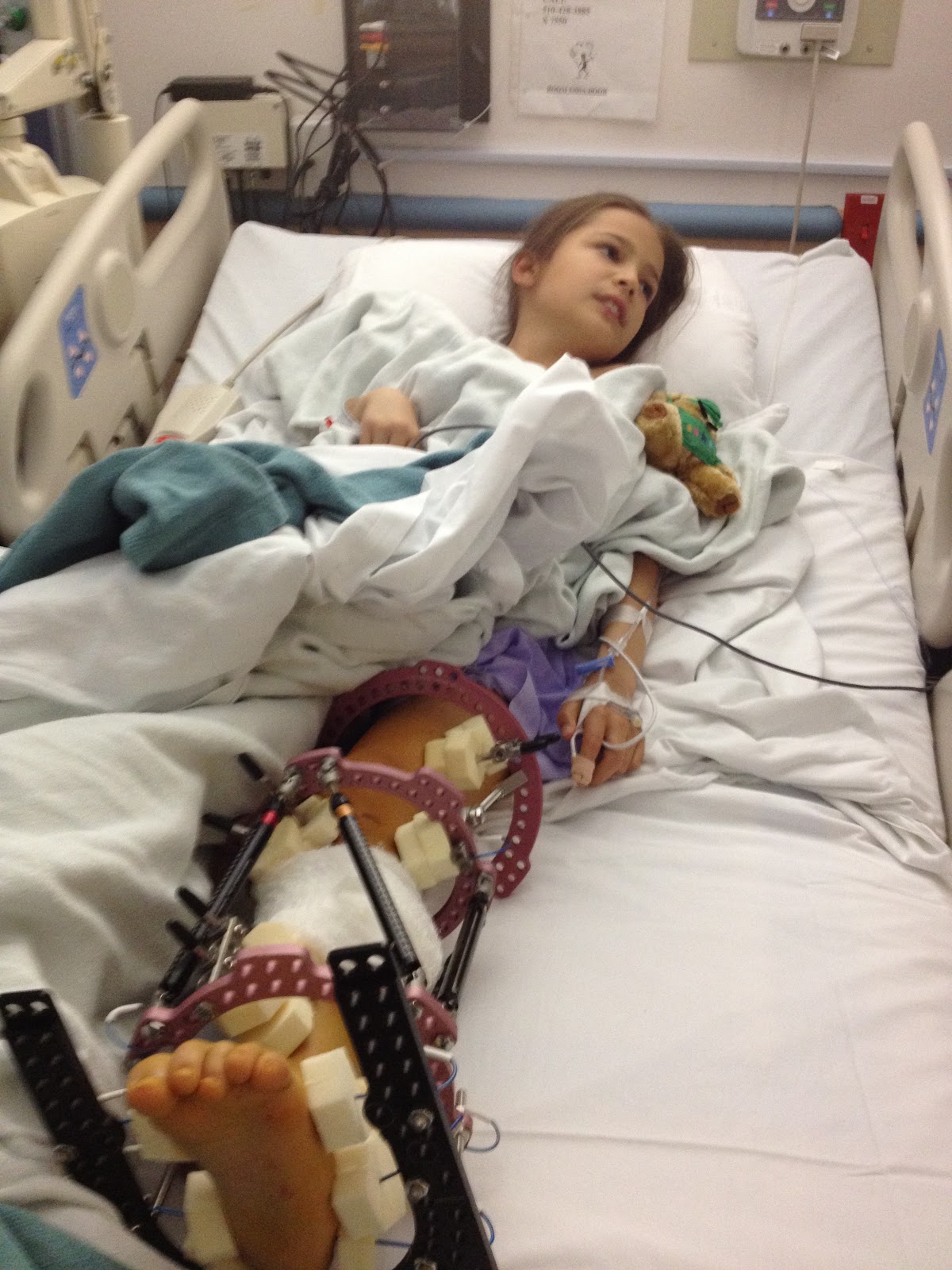fibular hemimelia leg lengthening Hospital photos Day 1