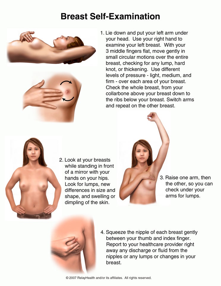 breast lump second opinion Older sagging breasts