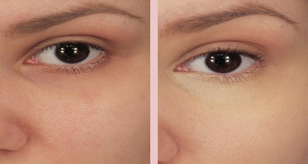 Put Baking Soda Under Your Eyes and the Results Will Be Amazing! Put Baking Soda Under Your Eyes and the Results Will Be Amazing!